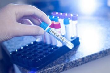 ESPÍRITO SANTO DO PINHAL REGISTRA CERCA DE 75% DE PACIENTES CURADOS DA COVID-19